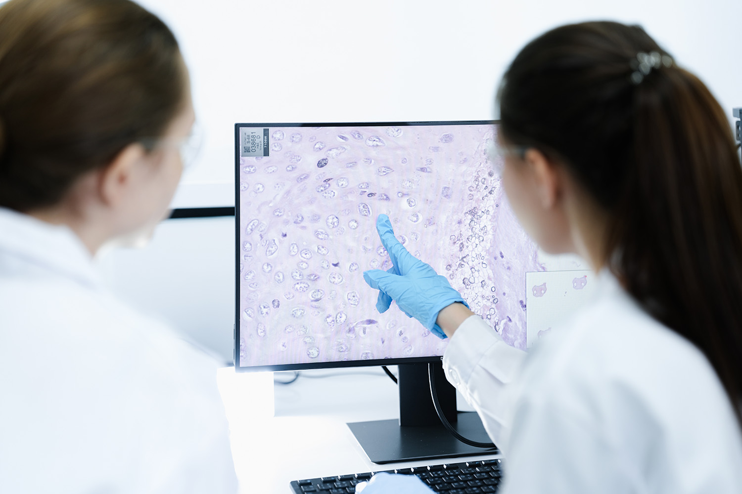 UOSD di Cito-Istopatologia e Anatomia Patologica